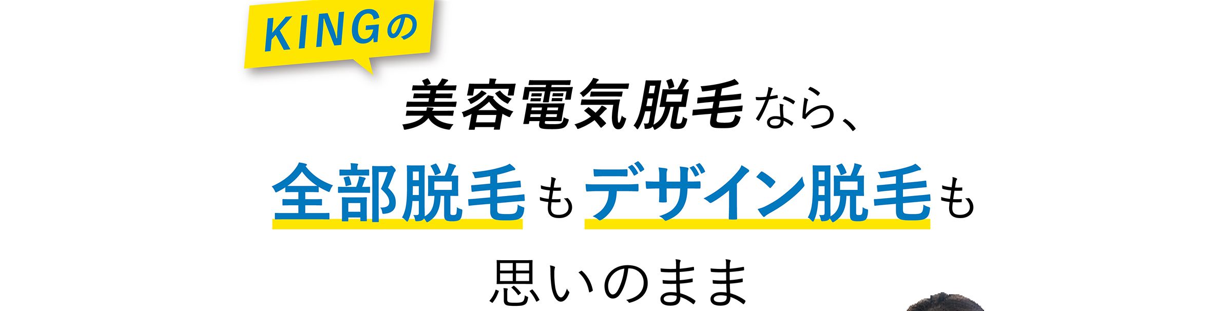 KINGの美容電気脱毛なら、全部脱毛もデザイン脱毛も思いのまま
