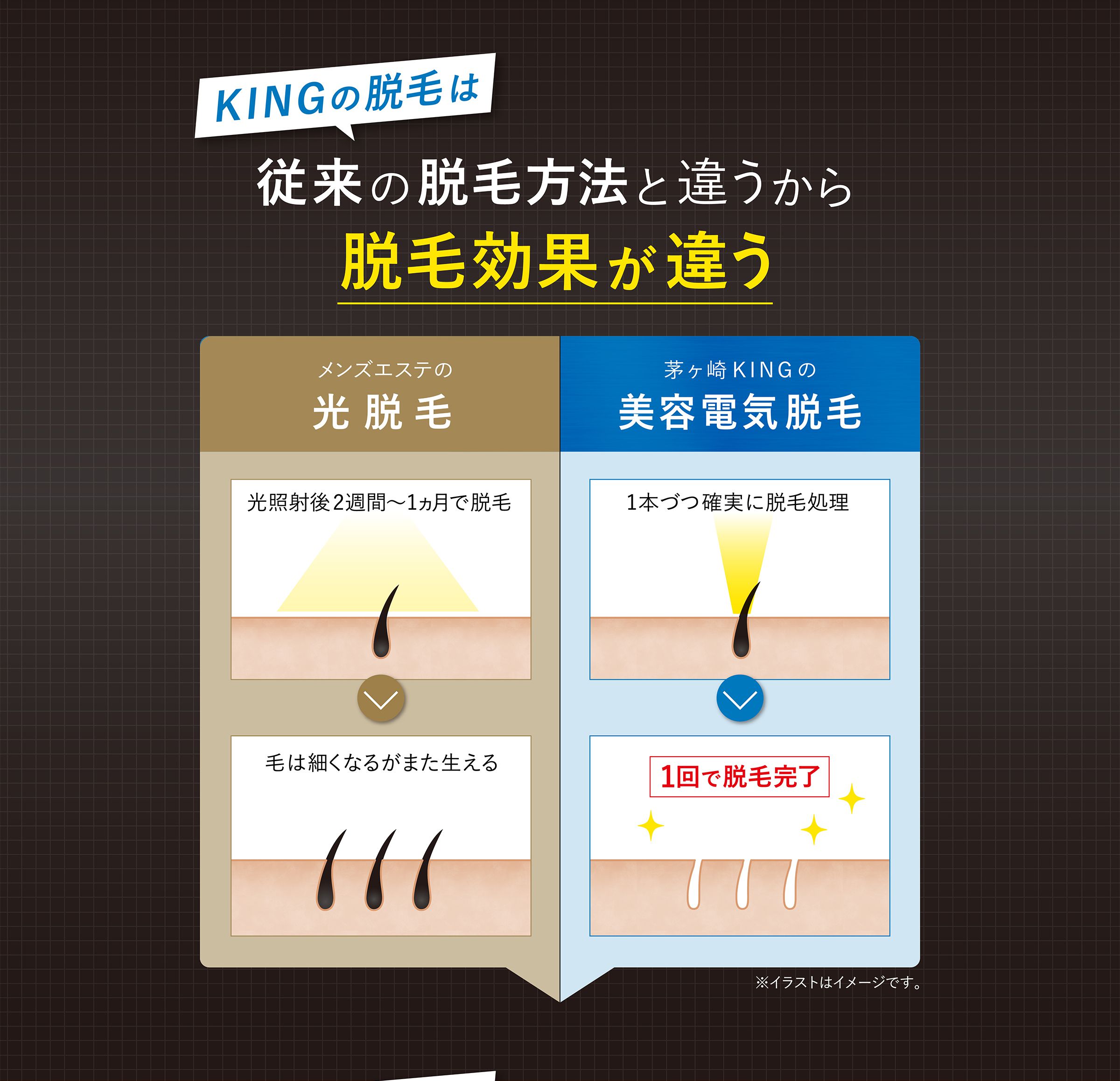 KINGの脱毛は従来の脱毛方法と違うから脱毛効果が違う 茅ヶ崎KINGの美容電気脱毛
