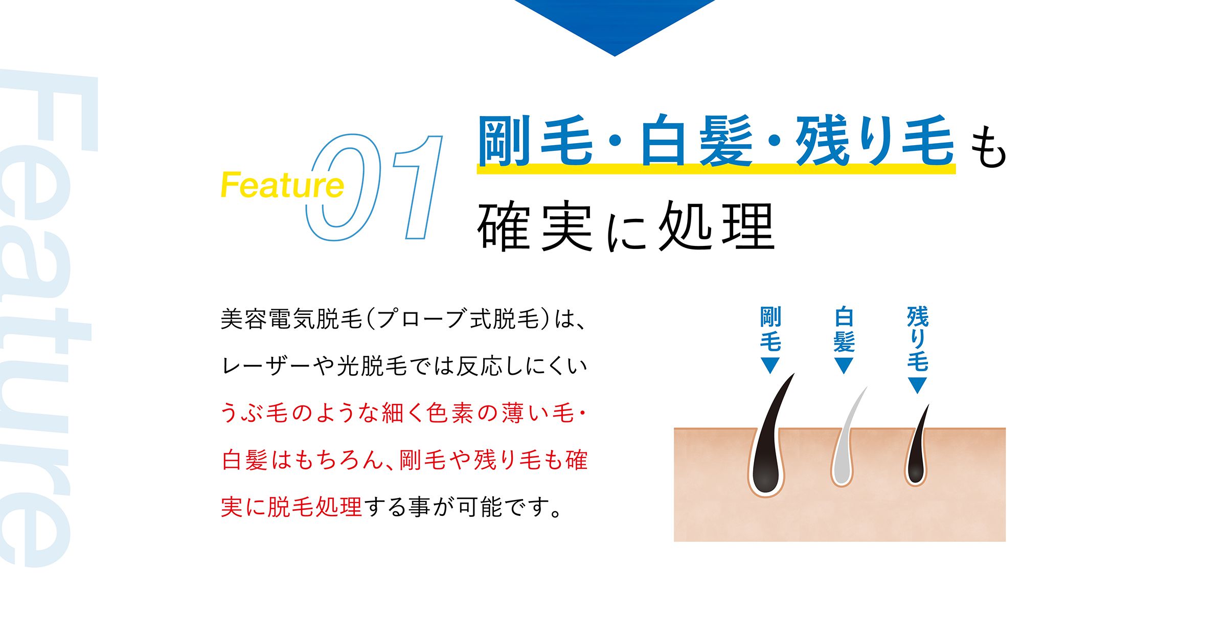 Feature01：剛毛・白髪・残り毛も確実に処理 美容電気脱毛（プローブ式脱毛）は、レーザーや光脱毛では反応しにくいうぶ毛のような細く色素の薄い毛・白髪はもちろん、剛毛や残り毛も確実に脱毛処理する事が可能です。