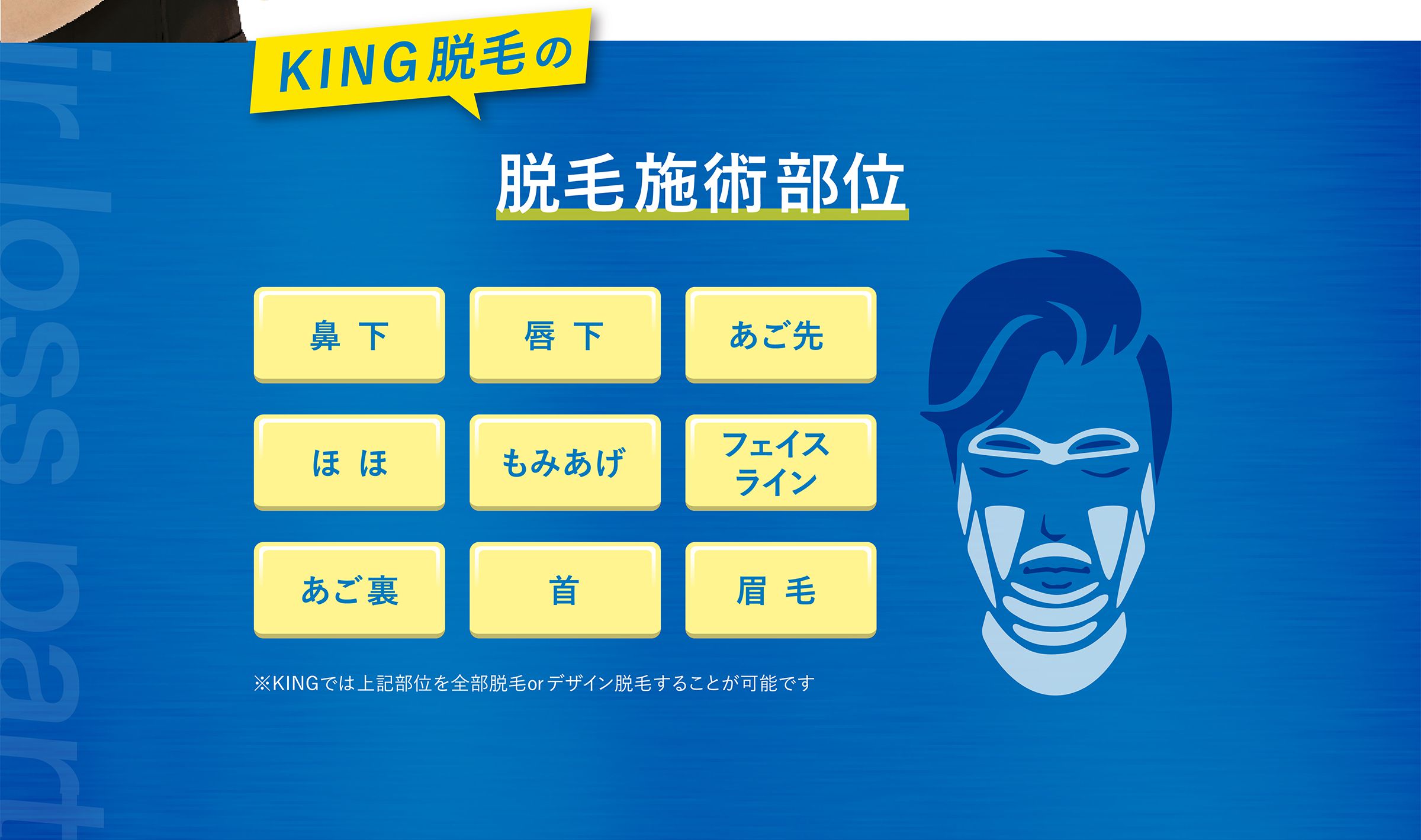 KING脱毛の脱毛施術部位 鼻下・唇下・あご先・ほほ・もみあげ・フェイスライン・あご裏・首・眉毛 ※KINGでは上記部位を全部脱毛orデザイン脱毛することが可能です
