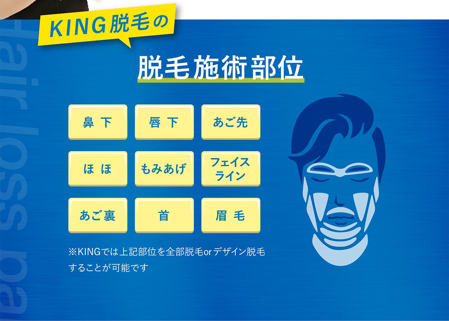 KING脱毛の脱毛施術部位 鼻下・唇下・あご先・ほほ・もみあげ・フェイスライン・あご裏・首・眉毛 ※KINGでは上記部位を全部脱毛orデザイン脱毛することが可能です